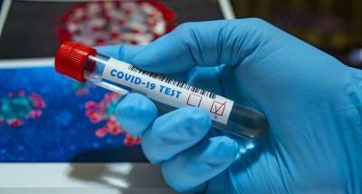 Povratak na dvoznamenkaste brojeve, 85 novih slučajeva koronevirusa u protekla 24 sata