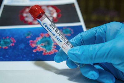 U Varaždinskoj županiji jedan novi slučaj zaraze koronavirusom