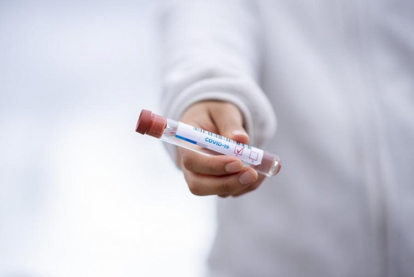 U Hrvatskoj na 6.587 testiranih 926 novih slučajeva zaraze koronavirusom