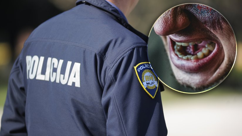 Napravio prometne prekr&scaron;aje pa počeo prijetiti ubojstvom, udarati, ali i gristi policajce...